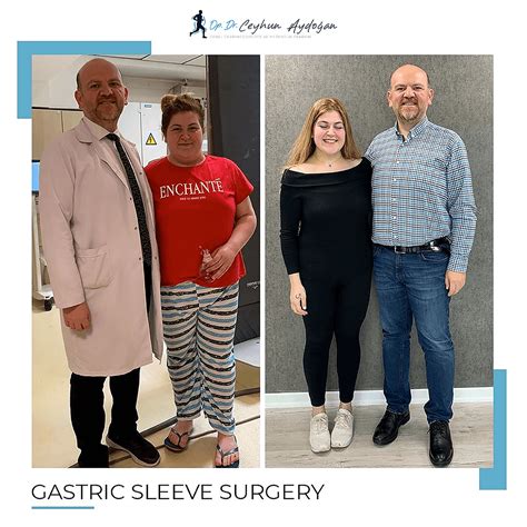 gastric sleeves in turkey.